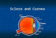 Sclera and Cornea cornea Sclera. Sclera It forms the posterior portion of the globe It forms the posterior portion of the globe It is perforated posteriorly