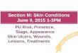 Section M: Skin Conditions June 9, 2015 1-3PM PU Risk, Presence, Stage, Appearance Skin Ulcers, Wounds, Lesions, Treatments