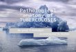 1 Pathological anatomy of TUBERCULOSIS According prof Ya. Bodnar As.-prof. V.Voloshyn