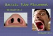 Gastric Tube Placement Nasogastric Orogastric. Introduction  What is a gastric tube  Anatomy review  Indications  Contraindications  Flight environment