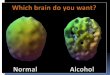TEENAGERS: DRINKING AND DRUGS A 15 year old’s brain image: Not a drinker A 15 year old’s brain image: a drinker