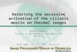Detecting the excessive activation of the ciliaris muscle on thermal images Balázs Harangi Faculty of Informatics, University of Debrecen SSIP 2009, 10