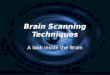Brain Scanning Techniques A look inside the Brain