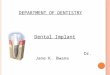 DEPARTMENT OF DENTISTRY Dental Implant Dr. Jane K. Bwana