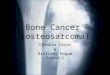 Bone Cancer (osteosarcoma) CaroLea Casas & Brittany Hogue Period 3