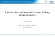Extraction of Vessels from X-Ray Angiograms Titus Rosu Prof. Dr. Rupert Lasser Andreas Keil
