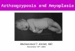Arthrogryposis and Amyoplasia Mohammed T. Attiah, MD November 10 th - 2003