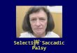 207-2 Selective Saccadic Palsy. Selective Saccadic Palsy after Cardiac Surgery Selective loss of all forms of saccades (voluntary and reflexive quick