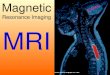 Magnetic Resonance Imaging MRI. Magnetic Resonance Imaging MRI uses the interaction between the magnetic properties of hydrogen nuclei, external magnetic