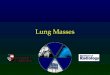 Lung Masses. Common causes of a mass on a CXR Benign nodules Primary lung cancer Metastatic disease Lung abscess There are many other causes, but these