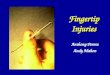 Fingertip Injuries Anthony Perera Andy Mahon. Nail Bed Anatomy Nail –keratinised squamous epithelium, acts as protective plate and increases sensitivity