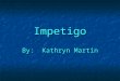 Impetigo By: Kathryn Martin. Information Basic Description Impetigo is a superficial disease. This means that it is on the surface of skin. Impetigo