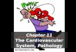 Chapter 11 The Cardiovascular System, Pathology. The Heart: Myocardial Infarction  M.I. = Coronary = Heart Attack  Occurs due to lack of blood (oxygen)