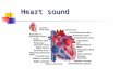 Heart sound. What we hear ? We have all heard the heart make the usual sounds. LUB----------DUB Lub is the first sound or S1 Dub is the second heart sound