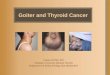 Goiter and Thyroid Cancer Hasan AYDIN, MD Yeditepe University Medical Faculty Department of Endocrinology and Metabolism