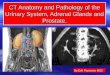 CT Anatomy and Pathology of the Urinary System, Adrenal Glands and Prostate. By Erik Poyourow MS3