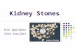 Kidney Stones Kim Applebee Alex Kaullen. Definition Kidney Stones are small, hard deposits of mineral and acid salts on the inner surfaces of the kidneys