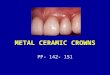 METAL CERAMIC CROWNS PP- 142- 151. METAL-CERAMIC RESTORATION ALSO CALLED PORCELAIN FUSED TO METAL RESTORATION (PFM). CONSIST OF A CERAMIC LAYER BONDED