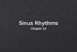Sinus Rhythms Chapter 13. Normal Sinus Rhythm Autonomic Nervous System Sympathetic nerves Parasympathetic nerves (vagus nerve) Autonomic Nervous System