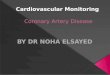 ï‚‍ What is Coronary Heart Disease? ï‚‍ Who is at Risk for Coronary Heart Disease? ï‚‍ Signs and Symptoms of Coronary Heart Disease. ï‚‍ How Is Coronary Heart