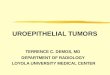 UROEPITHELIAL TUMORS TERRENCE C. DEMOS, MD DEPARTMENT OF RADIOLOGY LOYOLA UNIVERSITY MEDICAL CENTER