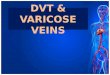DVT & VARICOSE VEINS. DVT It is the most common venous disorders result from incompetent valves in the veins and obstruction of venous return to the