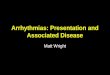 Arrhythmias: Presentation and Associated Disease Matt Wright