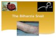 The Bilharzia Snail.  The snail is just the carrier of the Schistosomiasis parasitic disease.  Schistosomiasis, or bilharzia, is a parasitic disease