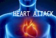 HEART ATTACK. WHAT IS A HEART ATTACK? Heart attack : Myocardial infraction or acute myocardial infarction (AMI) is the medical term for an event commonly