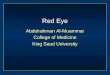 Red Eye Abdulrahman Al-Muammar College of Medicine King Saud University
