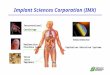 Implant Sciences Corporation (IMX) Radioactive Prostate Seeds Total Joint Implants Interventional Cardiology Semiconductor Explosives Detection Systems