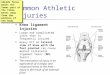 Common Athletic Injuries Knee ligament injuries Large and complicated joint that is frequently injured. Heavy hit on lateral side of knee with the foot