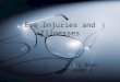 Eye Injuries and Illnesses Bucky Boaz, ARNP-C. Anatomy of the Eye