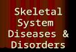 Skeletal System Diseases & Disorders. Osteoporosis