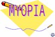 1. 2 3 MYOPIA Short sightedness Myopia is a greek word meaning *close the eye* Refractive error I Parallel rays of light coming from infinity are focused