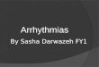 By Sasha Darwazeh FY1 Arrhythmias. Types of arrhythmias Site of abnormality: ● Supraventricular ● Ventricular Abnormalities of heart rate: ● Tachyarrhythmias