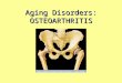 Aging Disorders: OSTEOARTHRITIS. OSTEOARTHRITIS Normal Sinovial Joint Function Why the Elderly Are Susceptible Osteoarthritis (OA) â€“What is Osteoarthritis?