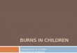 BURNS IN CHILDREN A Lecture by Dr. B. O. Edelu Department of Paediatrics