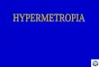 The term hypermetropia is derived from hyper meaning “In excess” met meaning “measure” & opia meaning “of the eye”. Also called hyperopia / longsightedness