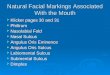 Natural Facial Markings Associated With the Mouth  Klicker pages 30 and 31  Philtrum  Nasolabial Fold  Nasal Sulcus  Angulus Oris Eminence  Angulus