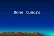 Bone tumors. 1-Primary bone tumors BenignBenign MalignantMalignant 2- Secondary (metastatic) bone tumors