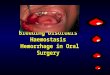 Bleeding Disorders Haemostasis Hemorrhage in Oral Surgery