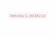 TAKAYASU’S ARTERITIS. 1761-Morgagni 1830- Yamamoto 1905- Takayasu, prof of ophthal, presented the case of a 21 year old woman with characteristic fundal