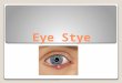 Eye Stye. What is an Eye Stye? Looks like a small pimple like bump on the eyelid. Often has a yellow or white color to it. Can be on one eyelid or both