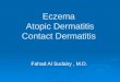 Eczema Atopic Dermatitis Contact Dermatitis Fahad Al Sudairy, M.D