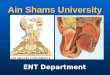 Ain Shams University ENT Department. The Ear Trauma to External Ear Haematoma Auris It is collection of blood under auricular perichondrium. It is collection