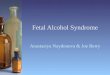 Fetal Alcohol Syndrome Anastasiya Naydonova & Joe Berry