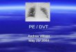 PE / DVT Andrea Wilson May 20/ 2004. Virchow’s triad  Hypercoagulability  Stasis  Venous injury