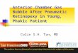 Anterior Chamber Gas Bubble After Pneumatic Retinopexy in Young, Phakic Patient Colin S.H. Tan, MD The authors have no financial or proprietary interests