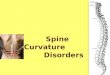 Spine Curvature Disorders. 123 The spine, or backbone, is made up of small bones (vertebrae) stacked -- along with discs -one on top of another. A healthy